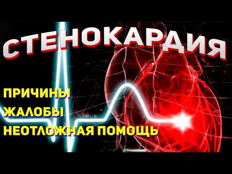 Стенокардия напряжения  - проявление и неотложная помощь