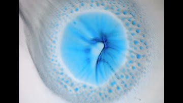 O2W, the fully dilutable SMEDDS, micellization process under light microscope