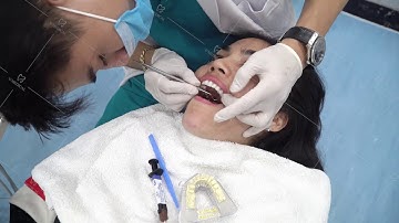 CA LẮP 16 RĂNG SỨ KATANA ĐẸP MÃN NHÃN - LỘT XÁC NỤ CƯỜI NGAY TỨC THÌ!