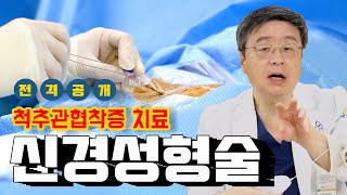 신경성형술이란 무엇일까? 그 궁금증 해결을 위한 척추협착증치료 과정 전격공개★