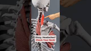 This is how to check if your NECK is causing Headaches + Dizziness! #dizziness #headaches #neckpain