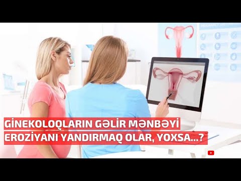 Video: Mənfəət Miqdarını Necə Tapmaq Olar