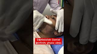 Lateral glide mobilization for TMJ dysfunction #tmj #tmj_pain #tmjtreatment #الام_المفاصل #تاهيل