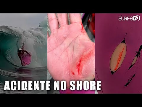 Acidente no Shorebreak (Eric Poseidon) - Vlog SURFE TV 153 #Shorebreak #Acidente #Perigo