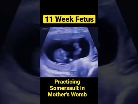 11 Week Fetus Practicing Somersault in Mother’s Belly😱🐣👶🏻#shorts#trending#youtube#subscribe#life