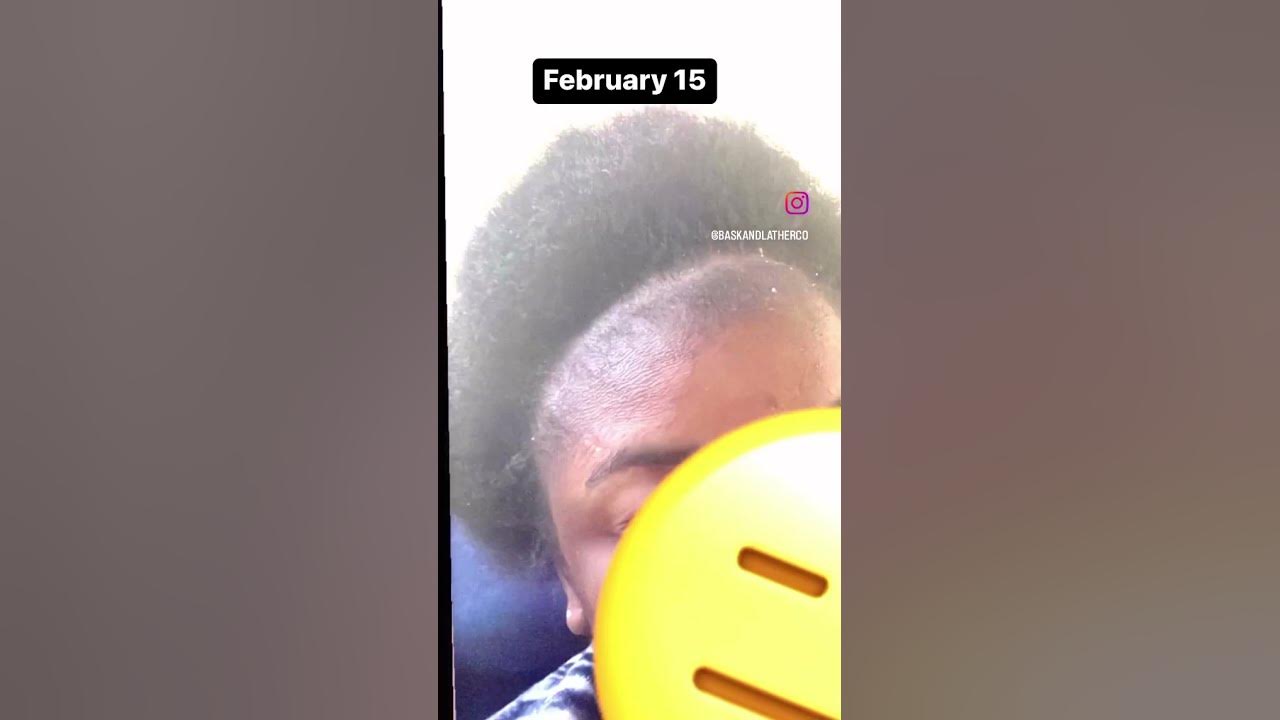 Bask and Lather Co Hair Growth Review After Using the Scalp Stimulator