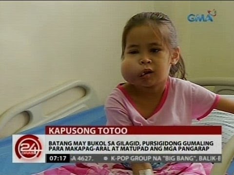 Video: Psychosomatics Ng Mga Sakit Ng Ngipin At Gilagid, Mula Sa Pananaw Ng Psychoanalysis