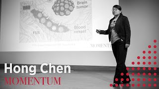 Two-way Transfer Across the Blood-Brain Barrier | Washington University