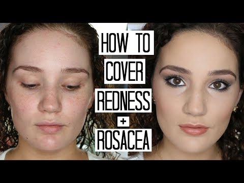 How to Cover Rosacea, Redness & Acne | All Calm Giveaway