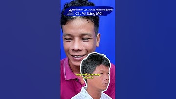 Hành Trình Lột Xác Của Anh Long Sau Khi Cắt Mí, Nâng Mũi #short #nangmui #catmimat