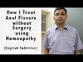 How i treat fissure without surgery using homeopathy  dr rohit jain explains