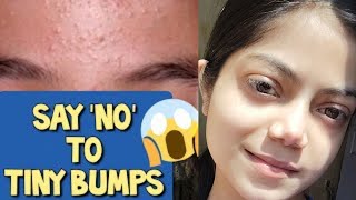 How to remove TINY BUMPS in 7 Days (100% Results)