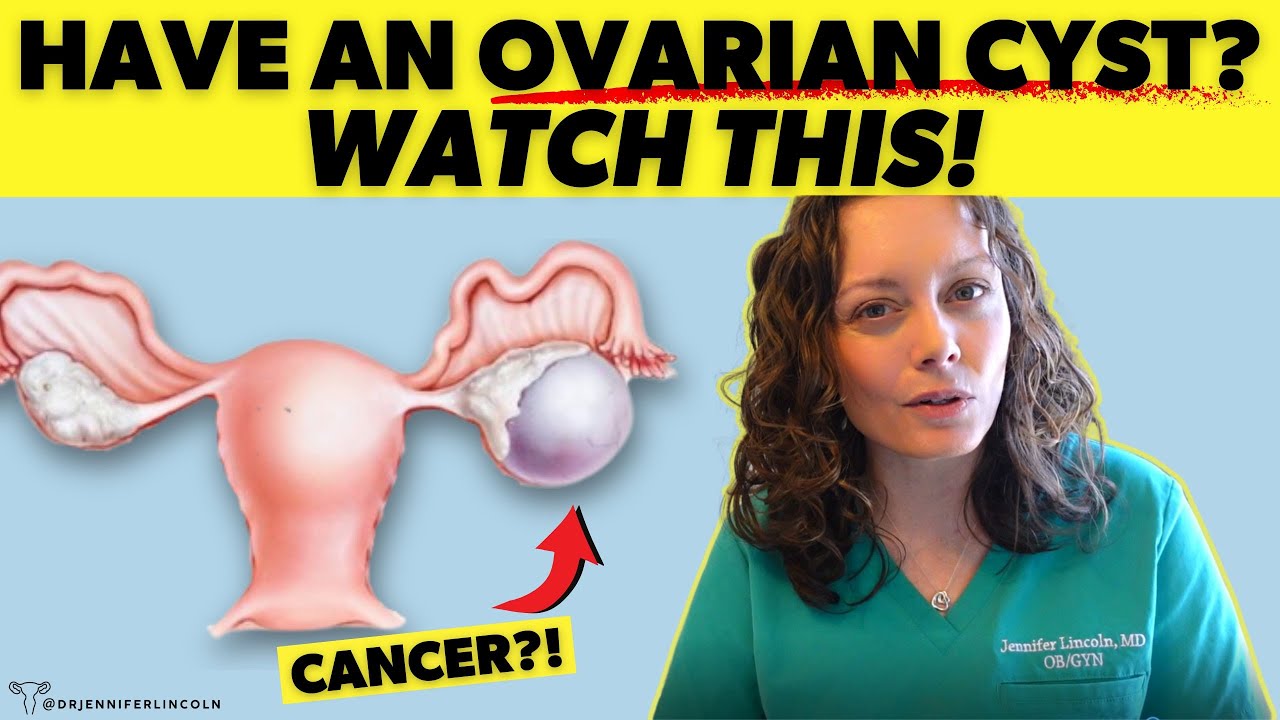 What To Know If You Have An OVARIAN CYST Dr Jennifer Lincoln YouTube What To Know If You Have An OVARIAN CYST Dr Jennifer Lincoln YouTube