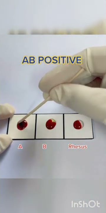 AB positive blood group 😱😇🤫