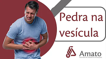 O que pode causar pedra na vesícula?