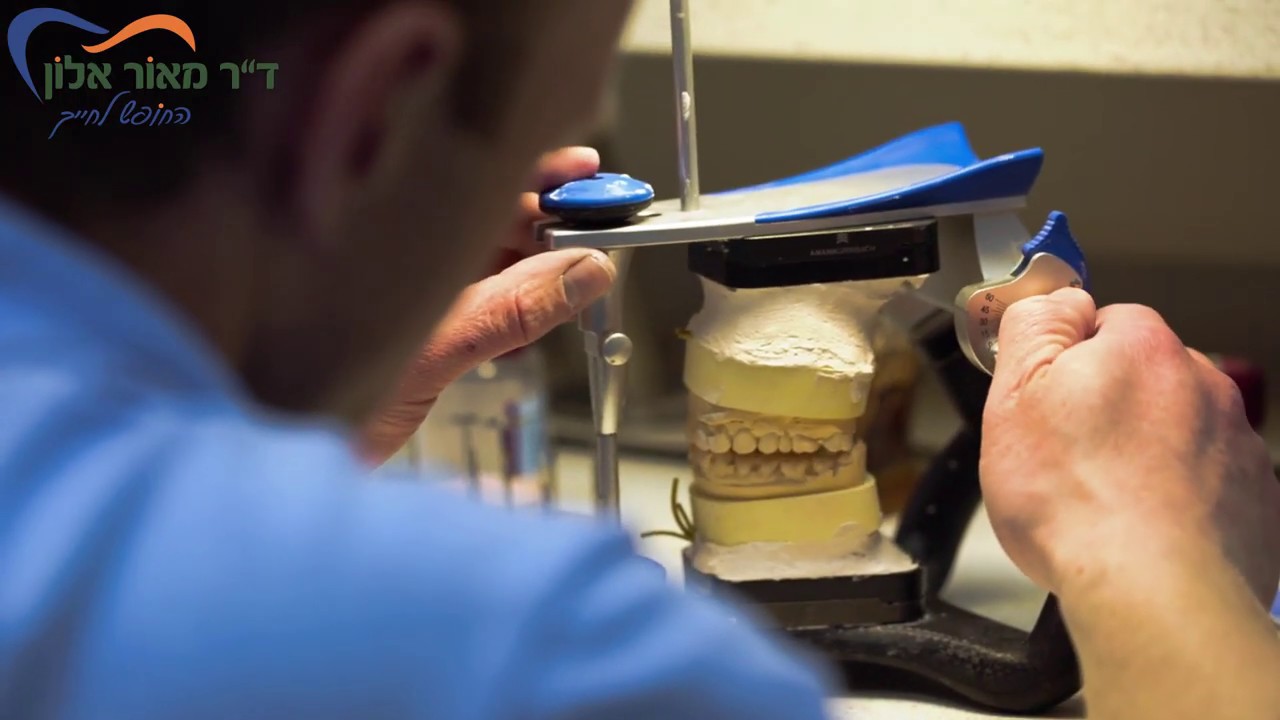 רופא שיניים בחולון ד"ר מאור אלון מסביר על השתלות שיניים ותותבות