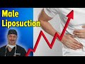 Male Liposuction Procedure Dr Schulman