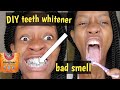 🔥Get WHITE Teeth!(in minutes) & smelly MOUTH ODORS 🔥 using baking SODA