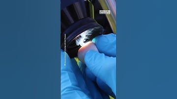 Wat gebeurt er als je met een telescoop naar de zon kijkt?