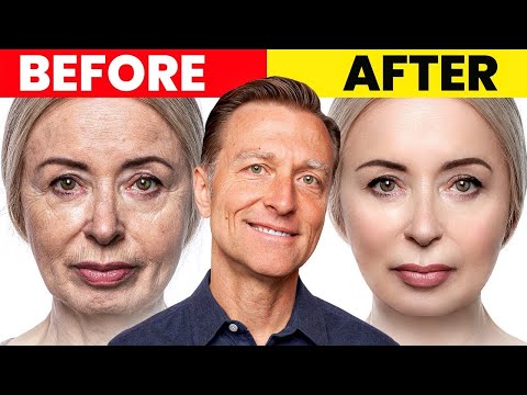 The Ultimate Face Transformation–Dr. Berg's Best Remedy for Dry Skin and Wrinkles