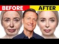 The ultimate face transformationdr bergs best remedy for dry skin and wrinkles