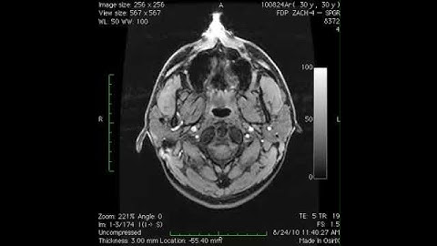 Open Source Brain Structural MRI Scan