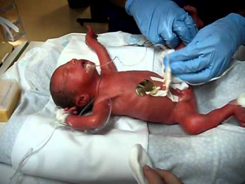 Jonah Allen Kain, 8 hours after birth receiving his first sponge bath