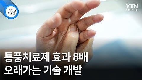 통풍치료제 효과 8배 오래가는 기술 개발 / YTN 사이언스