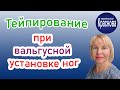 Тейпирование при вальгусной установке ног. Невролог Краснова.