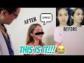 NOSE JOB HEALING PROCESS AND REVEAL!!! (1 WEEK AFTER SURGERY) | Angel Dei