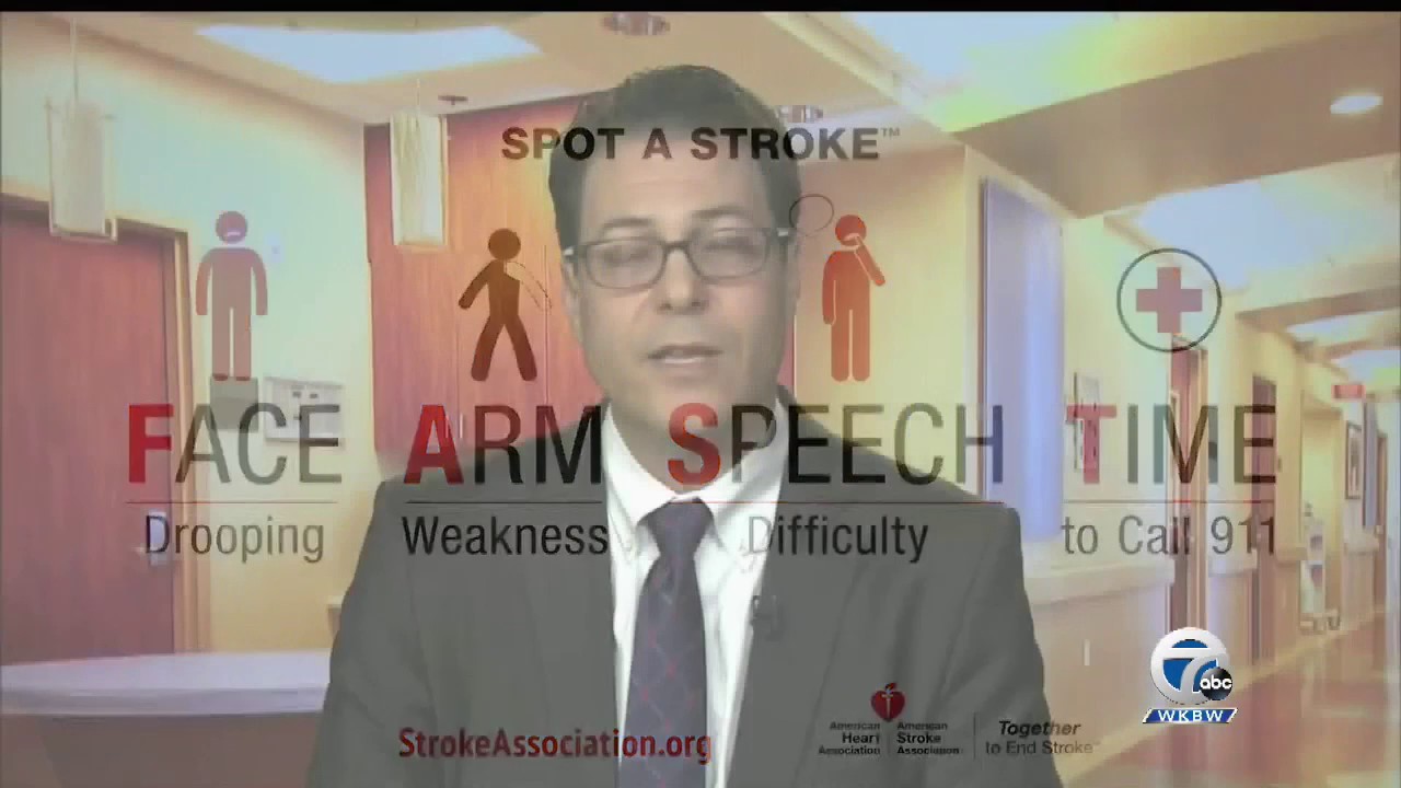 Can You Have A Stroke And Not Know It YouTube