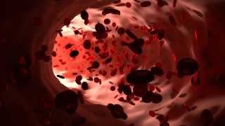 Attack of the Red Blood Cells