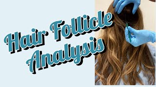 Hair Follicle Analysis