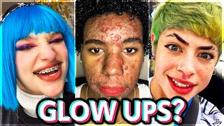 My Face Has Changed Now (GlowUps/GlowDowns) TikTok Compilation