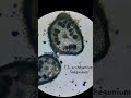 T.S. of Archegonium of Sargassum | Structure, Development &amp; Function #algae #biology #science