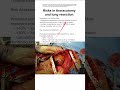 Risk assessment for thoracotomy and lung resection