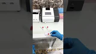 Virus Rapid Test| Analysis.تحليل الفايروساات رابد تيست