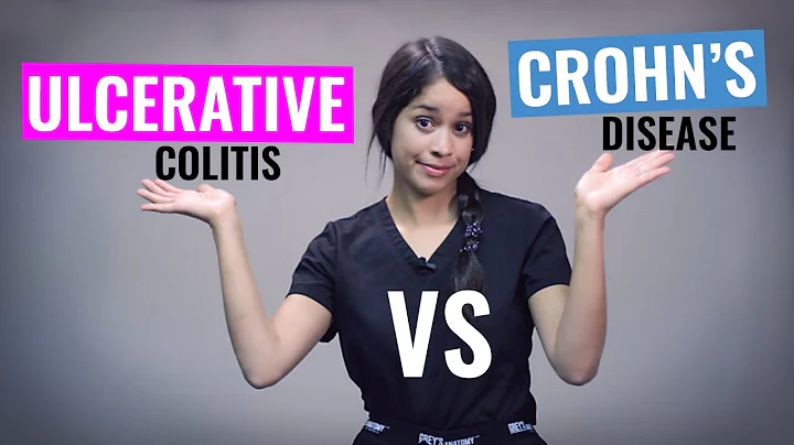 Ulcerative Colitis vs Crohn's disease Nursing | NCLEX Review | Christina NP