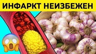 Эти 5 продуктов засоряют сосуды КАЖДЫЙ ДЕНЬ!