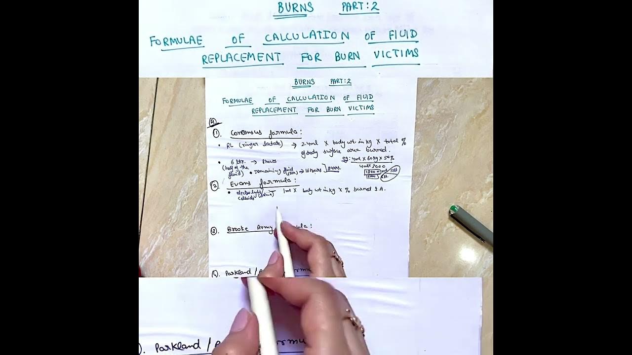 Burns Calculation of fluid replacement for burn victims YouTube