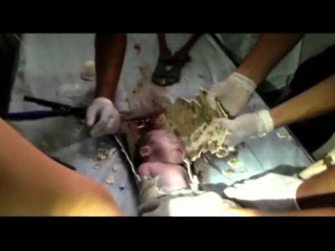 Video: increíble rescate de un bebe del desagüe de un inodoro