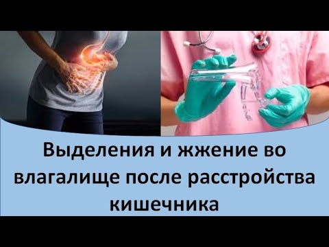 Выделения и жжение во влагалище после расстройства кишечника