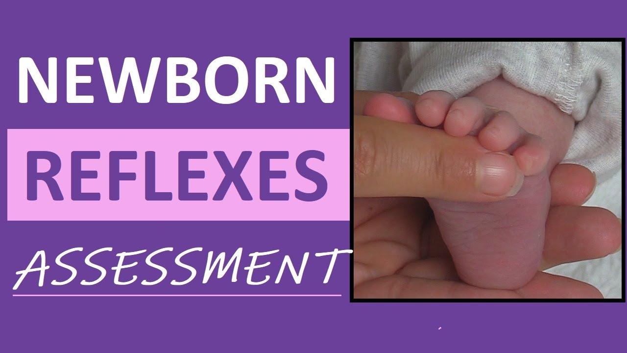 Newborn Reflexes Assessment (Infant) Nursing Pediatric NCLEX Review