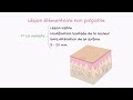 Lsions lmentaires en dermatologie aperu incroyable en 1 minute 