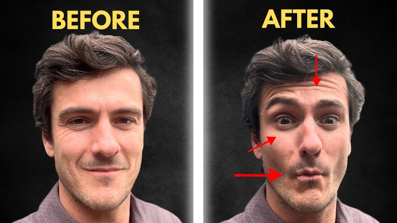 semaglutide rash on face Anyone else experiences hives/skin issues? : r/Ozempic face rash from semaglutide Explained