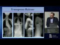 Outcomes of Adult Spinal Deformity Surgery - Justin S. Smith, MD, PhD