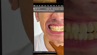 easiest way to whiten teeth in photoshop! #shorts