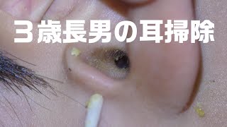 【耳掃除】３歳長男　初めての耳掃除　EARWAX