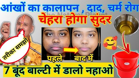 दाग,दाद,आखों का कालापन | चेहरा होगा सुंदर बस 7 बूंद लगा लो | pradeep Mishra ji daag dhabbe