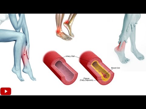 exercises-for-improving-blood-circulation-in-legs---by-dr-sam-robbins